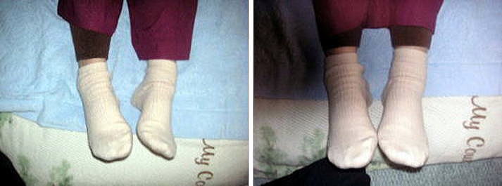 高齢の方でも無理なく骨盤矯正。