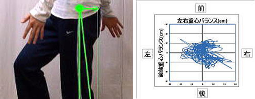 股関節痛の状態を確り見るには運動データが有力でした。