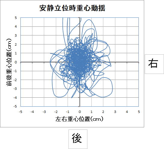 健康な方の安静立位時の重心バランスです。