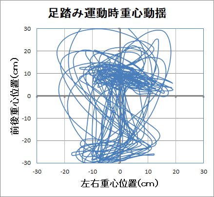 脊柱管狭窄症の 重心バランス図