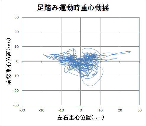 右坐骨神経痛の 重心バランス図